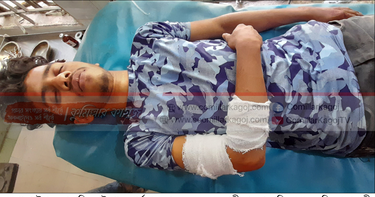 ব্রাহ্মণপাড়ায় সন্ত্রাসী হামলায় মুক্তিযোদ্ধার স্ত্রী ও ছেলে আহত ব্রাহ্মণপাড়ায় সন্ত্রাসী হামলায় মুক্তিযোদ্ধার স্ত্রী ও ছেলে আহত