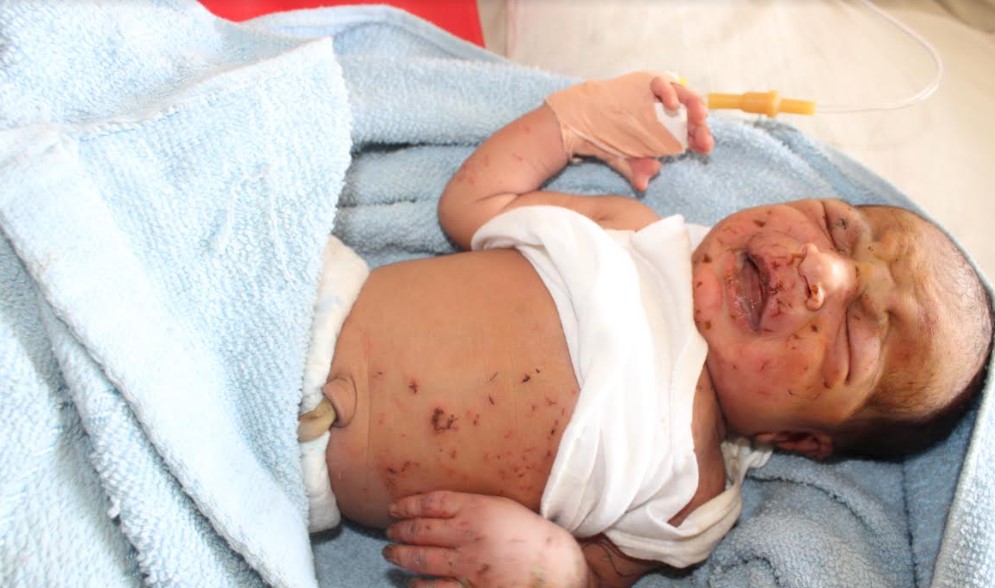 দেবীদ্বারে ফসলী জমির নালায় নবজাতক; স্থান পেল প্রবাসীর স্ত্রীর কোলে