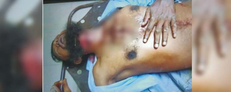 এবার সেই কিশোরীর পিতাকে গলা কেটে হত্যার চেষ্টা