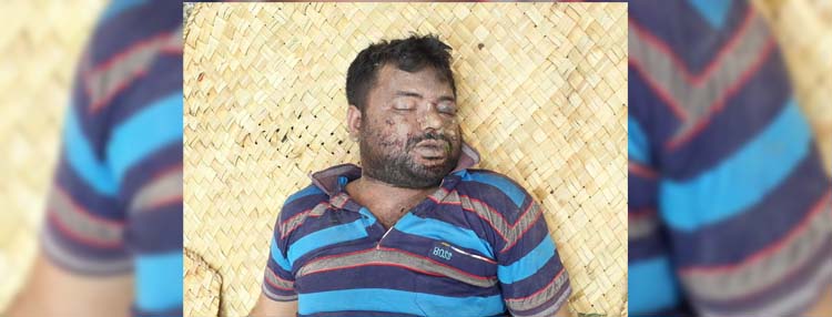 দাউদকান্দিতে অজ্ঞাত যুবকের লাশ উদ্ধার