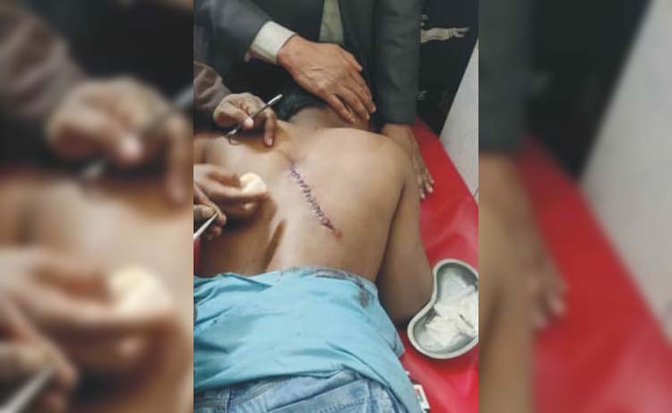 দেবিদ্বারে বেপরোয়া কিশোর গ্যাং 