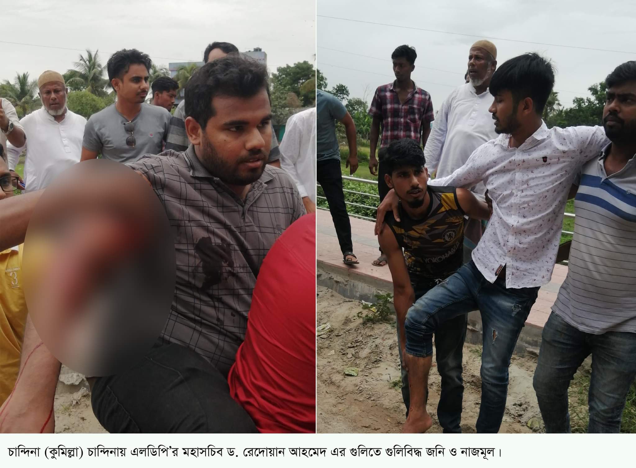 চান্দিনায় ড. রেদোয়ান আহমেদ এর গুলিতে গুলিবিদ্ধ ২