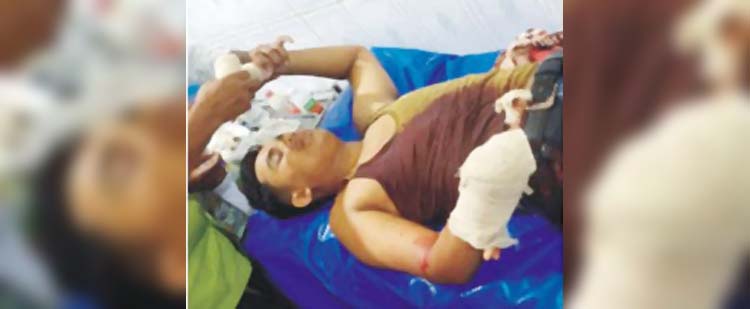 পিতাকে বাঁচাতে এসে হাতের কব্জি হারালো এসএসসি পরীক্ষার্থী 
